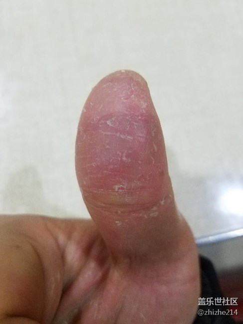 天殘手怎么用指紋識別